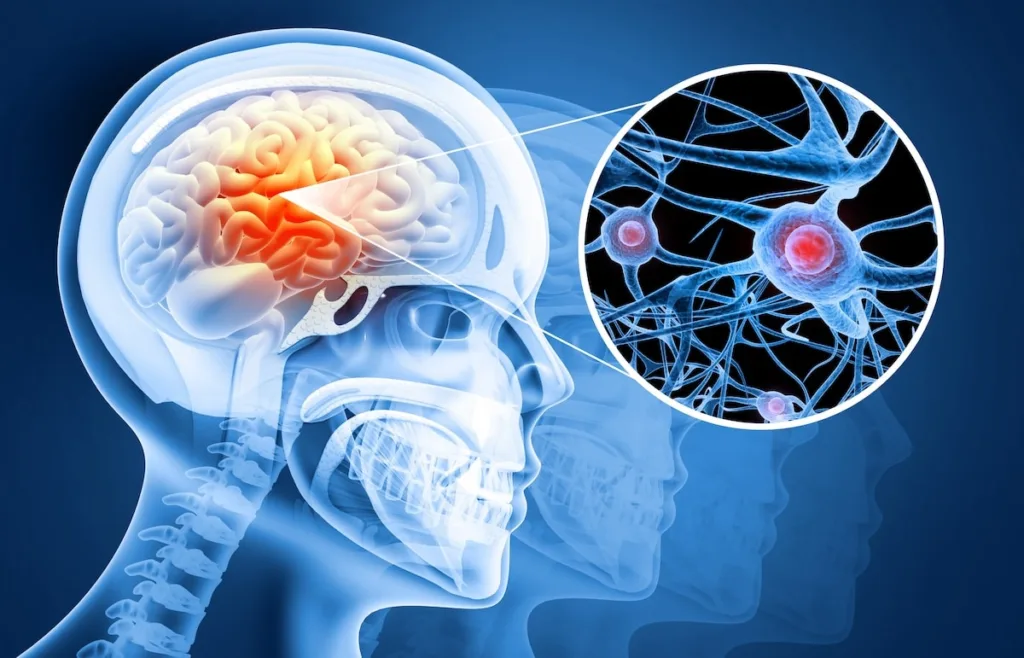 hjärnskakning-symptom-behandling-hjärnskada